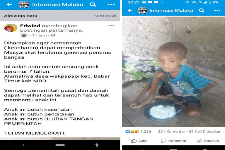 Viral di Facebook, Anak Penderita Gizi Buruk di MBD Butuh Perhatian Pemerintah